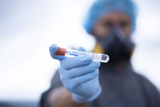 Eliminar la necesidad de receta triplicará la venta de test de covid-19