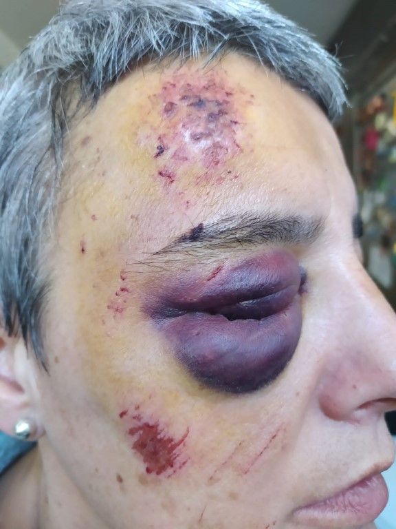 Rosario se encuentra con un tratamiento antidepresivo 